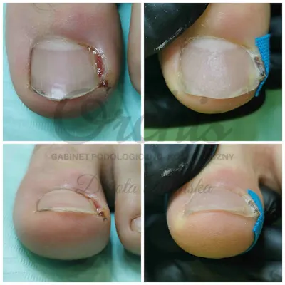 Podolog Toruń Klinika Podologii PodoPraktyka Dorota Zielińska